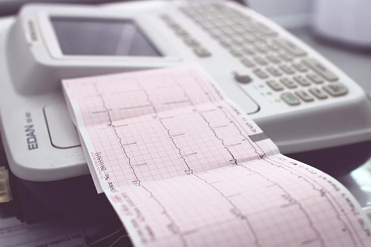 An EKG machine displaying a printed electrocardiogram readout.